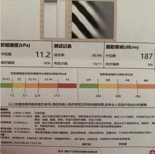 肝硬化患者注意，把握好这4个节点，你的逆转率大大提高！