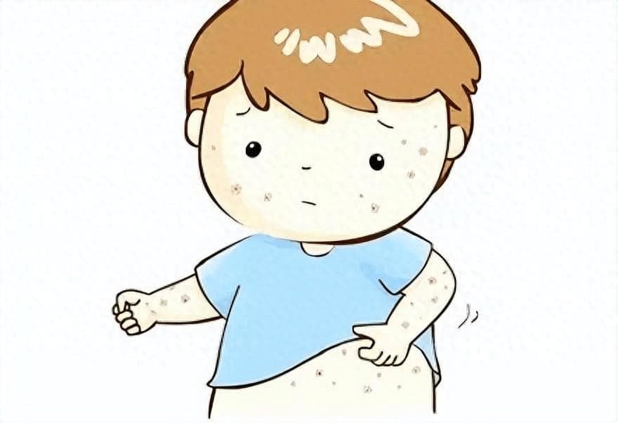 孩子患特应性皮炎，该怎么办？