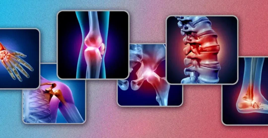 干细胞治疗骨关节炎新突破：875名患者研究证实其显著疗效