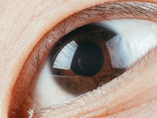 近视手术前必读：禁忌症、年龄度数要求、停戴隐形眼镜时间全解析