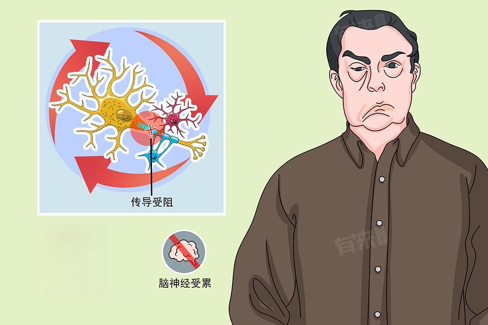 双腿突然酸软无力警惕