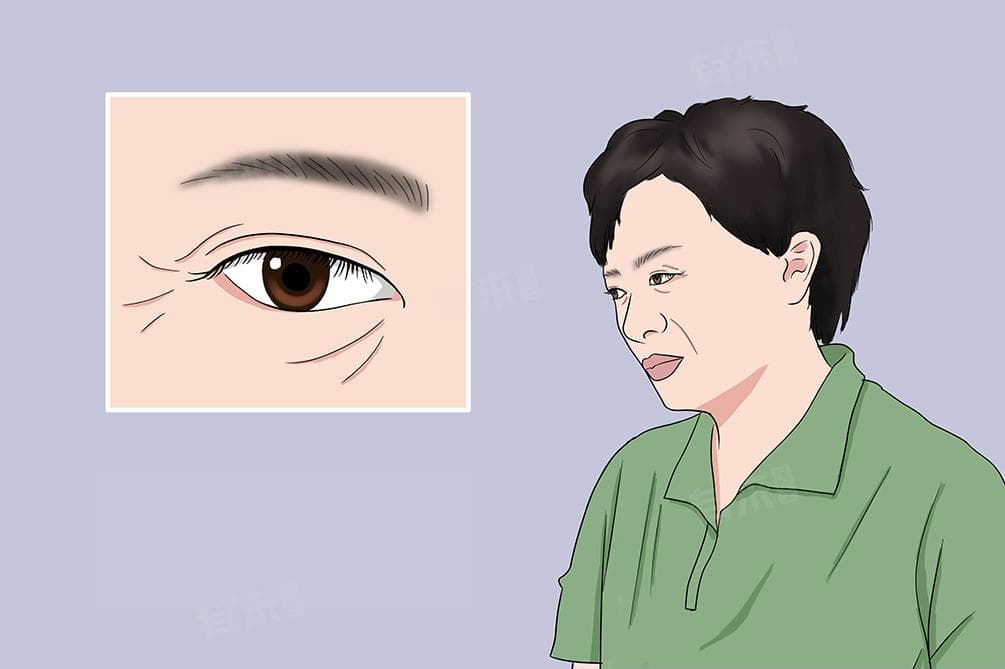眼睑下垂解决方法有哪些