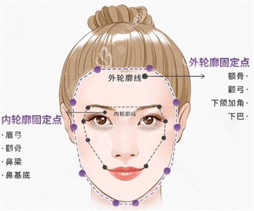 面部轮廓固定的固定方式与材料选择全解析！想改善面部轮廓的朋友看过来