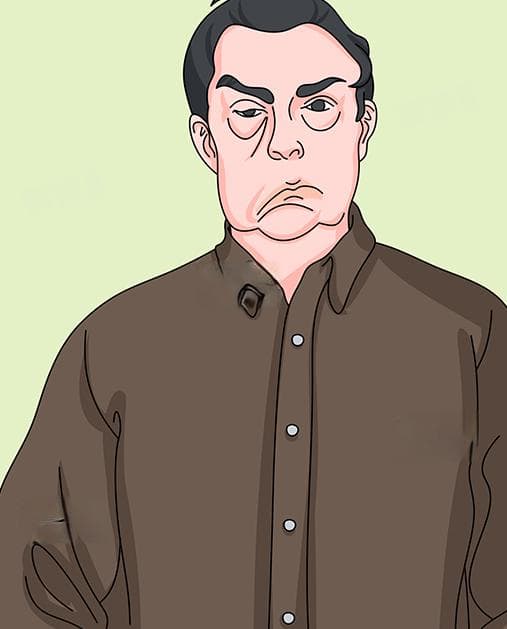 中风是指什么