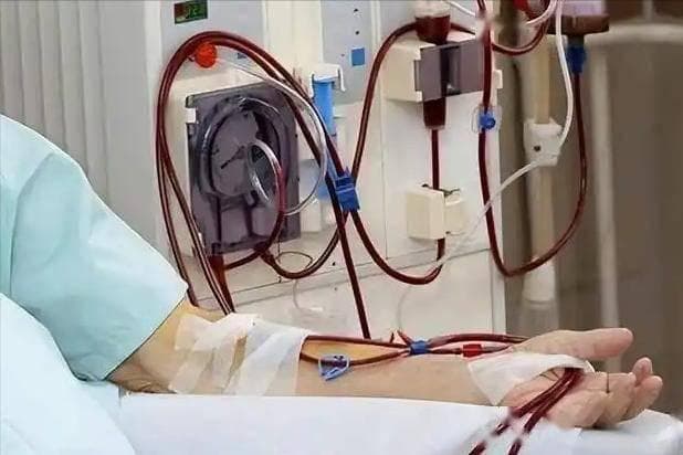医生：能活过70岁的尿毒症患者，除了接受治疗，日常还戒掉了3事
