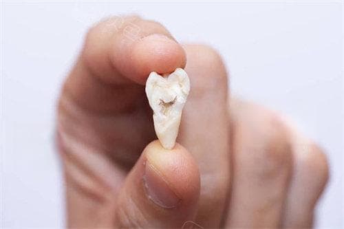 成人牙齿掉了一颗怎么处理？也可以不管/得分情况/不会再长出来！