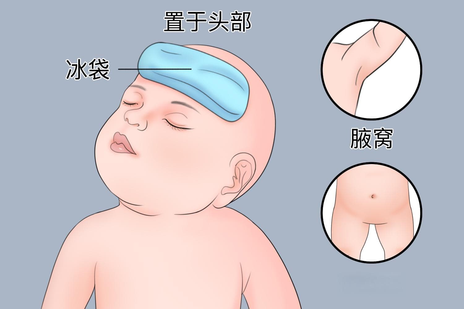 婴儿物理降温的正确方法