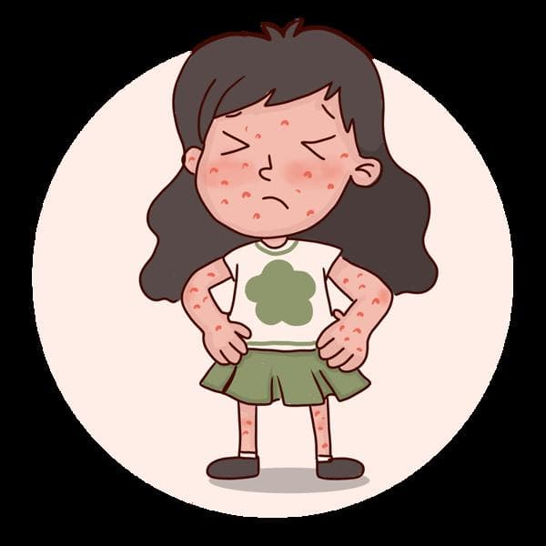 急性荨麻疹症状消失后还需服药多久？