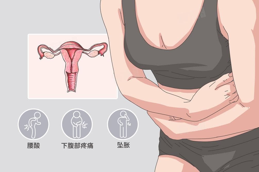 喝什么可以缓解痛经