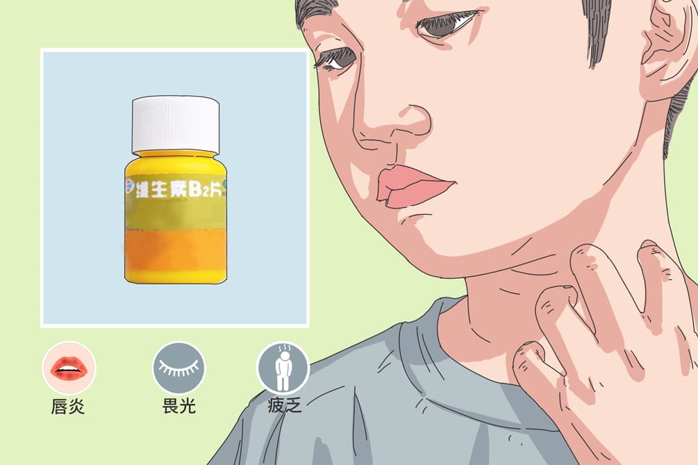 为什么维生素B2千万别乱补