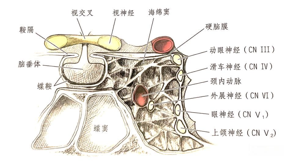 痛性眼肌麻痹：Tolosa-Hunt综合征的病因、诊断与治疗
