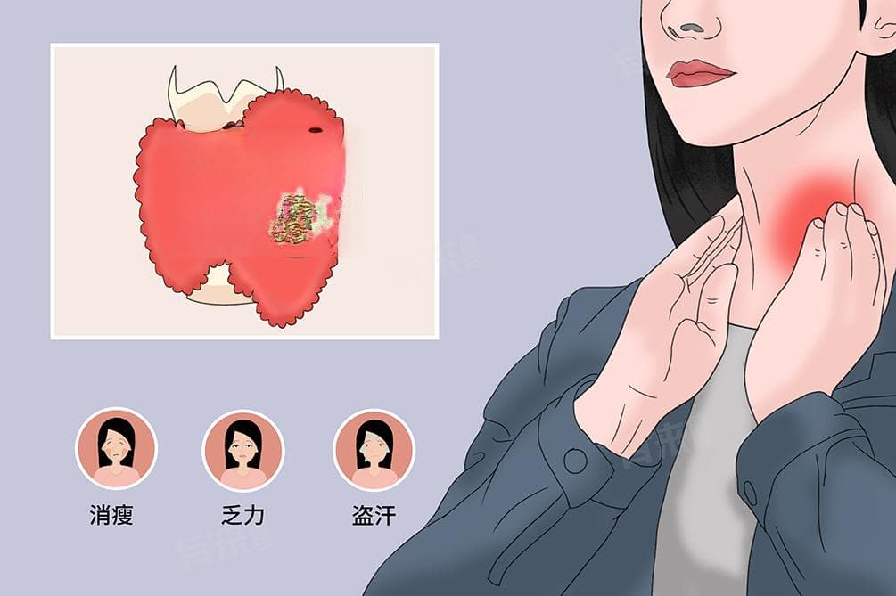 甲状腺结节怎么办