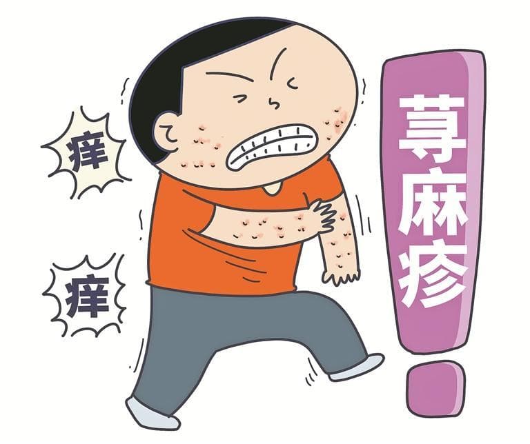 天冷易发荨麻疹 再痒也别用手抓
