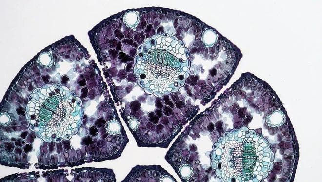 Nature Methods 前沿：空间转移张量方法解析细胞状态转变
