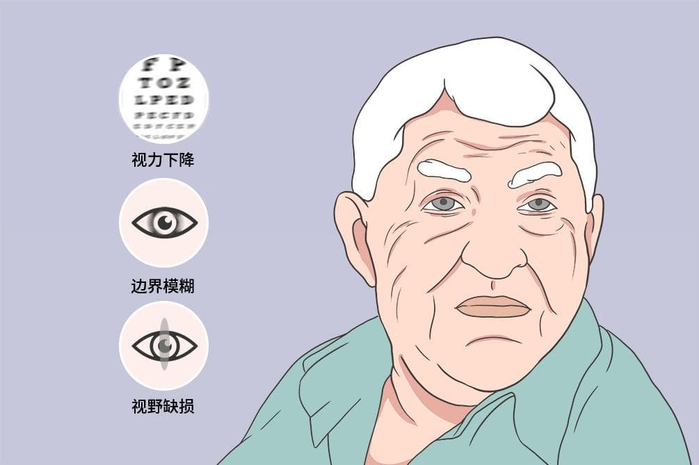 后发性白内障最好的治疗方法