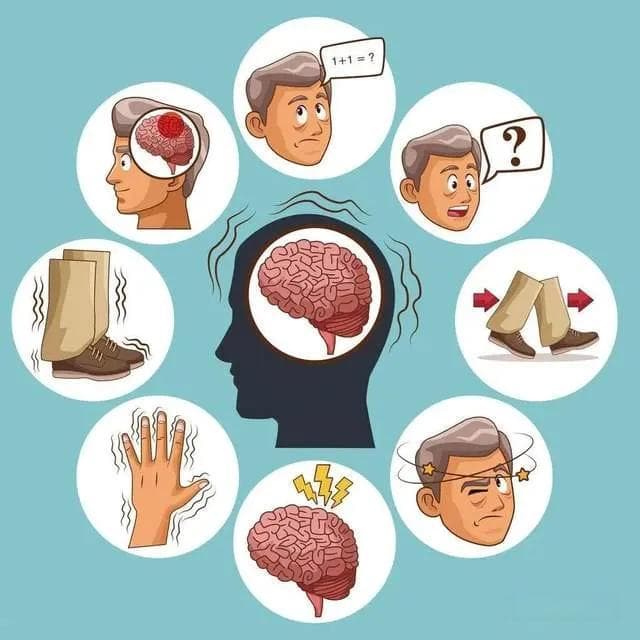 科普｜神经外科你需要知道的那些疾病