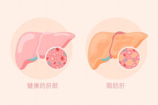 @中老年人群：拒绝盲目减肥！科学减重这样做