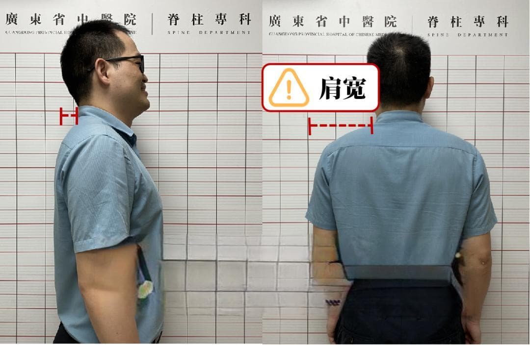 一觉醒来肩膀痛，特别是侧睡！名医告诉你，枕头不对有多伤