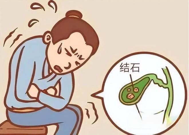 【明仁与健康】呵护胆囊，从饮食做起