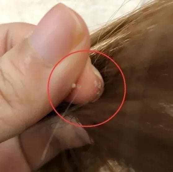 如何分清你的头皮类型？两招教你轻松判断！