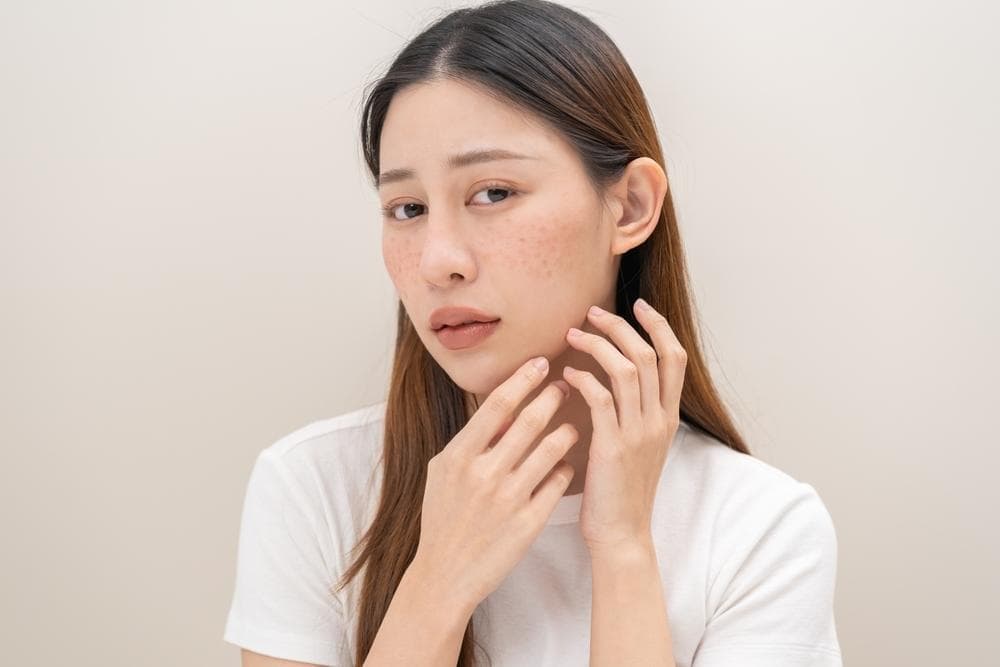 痘痘肌保养与改善怎么做？4招抗痘方法让粉刺痘远离你！
