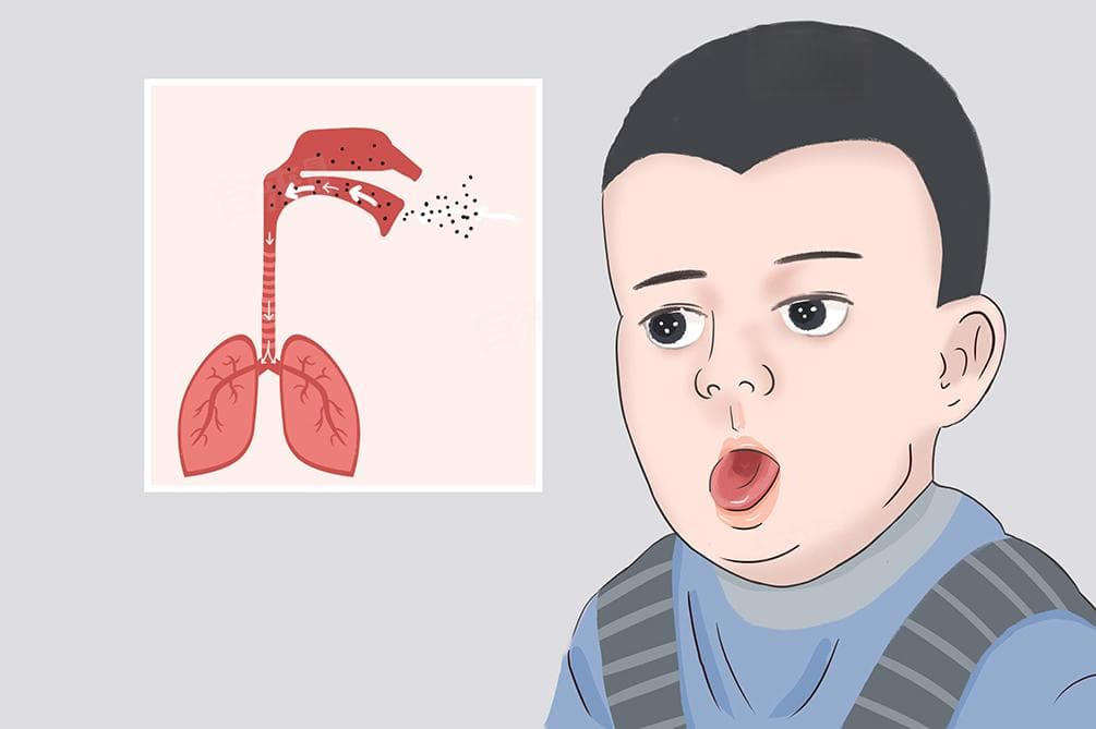 小孩咳嗽厉害怎么治疗最有效