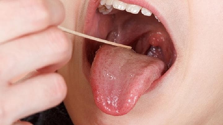 确诊淋巴水肿要做哪些检查