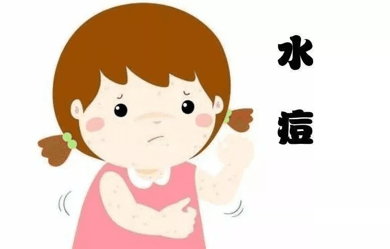 水痘号称“见面传”，学会这几招，帮助孩子远离它