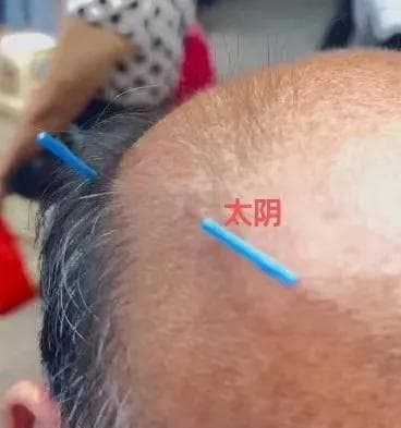 秋凉了，腰痛不用慌，中医有良方