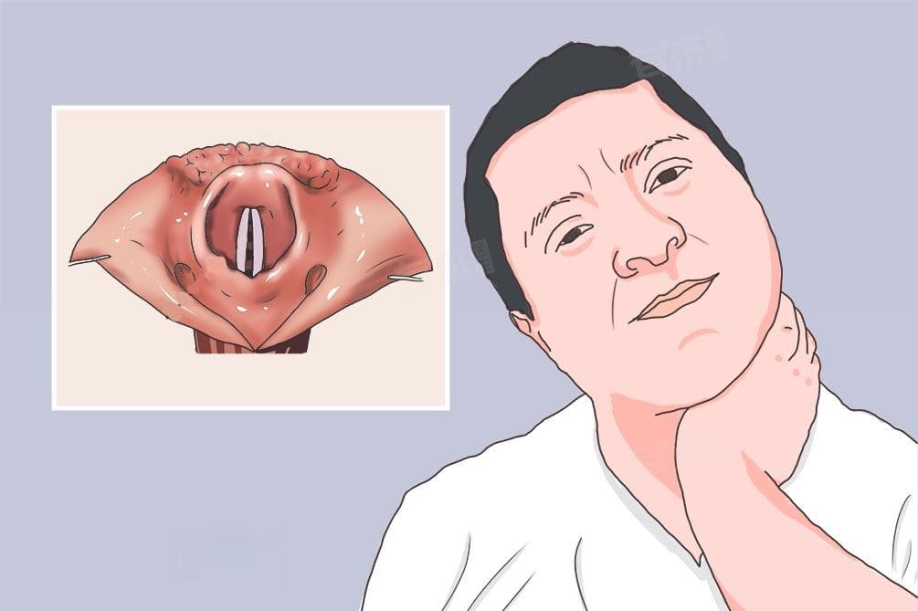 嗓子总是沙哑怎么办