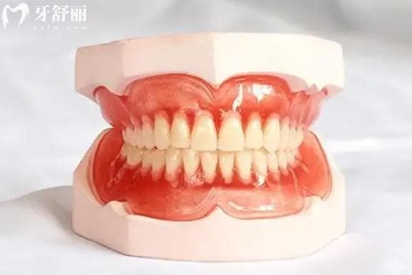 全口吸附性义齿使用寿命有多久？还有做假牙前必看优缺点整理