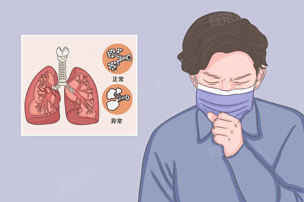 从饮食到治疗：专家详解支气管炎科学调理方案
