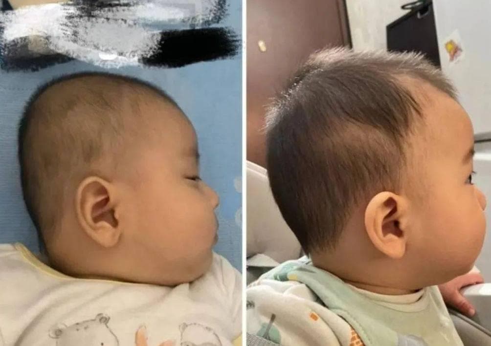 婴幼儿小时候用不用枕头，区别真的很大吗？3张图让家长明白