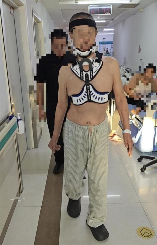 哈医大一院脊柱外科精准治疗寰枢椎脱位
