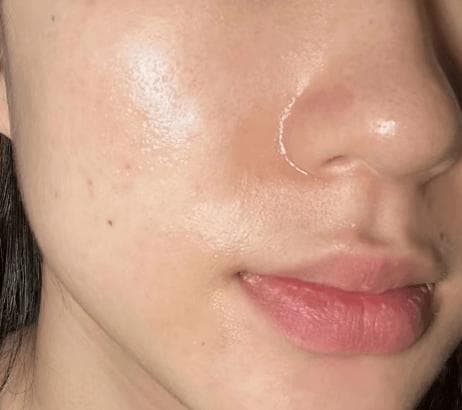 油皮不缺水？补水保湿同样重要
