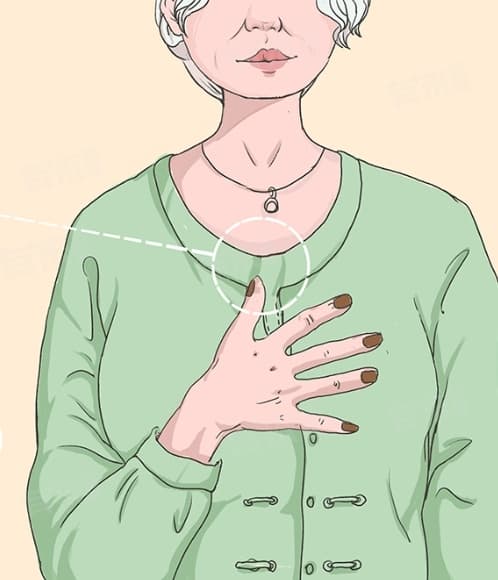 灰指甲是真菌感染吗？一文详解灰指甲的病因、症状与预防