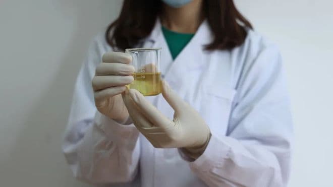 身体有病，尿液先知！发现尿液颜色深，有泡沫？可能隐藏3种疾病