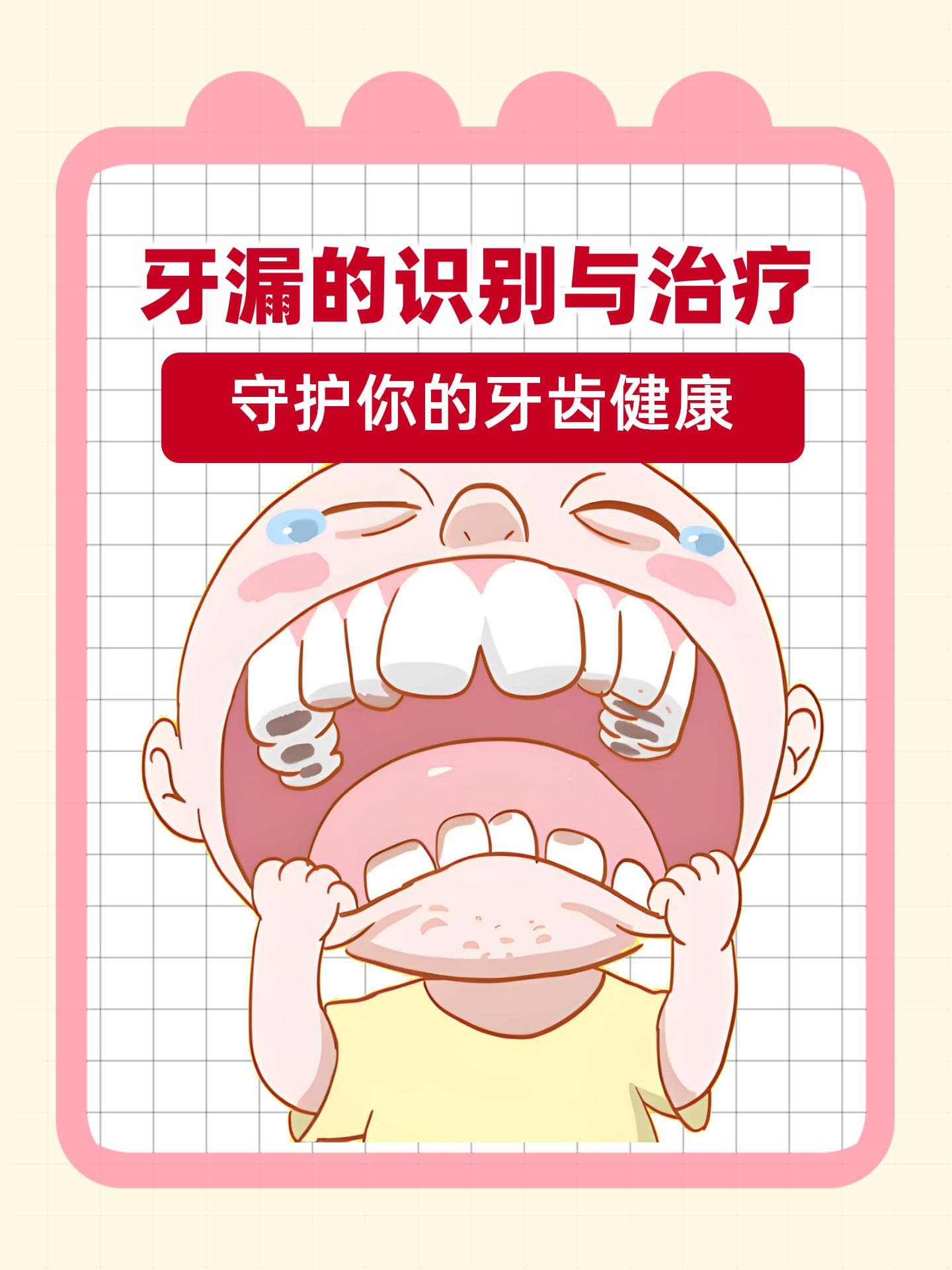 牙漏的识别与治疗：守护你的牙齿健康