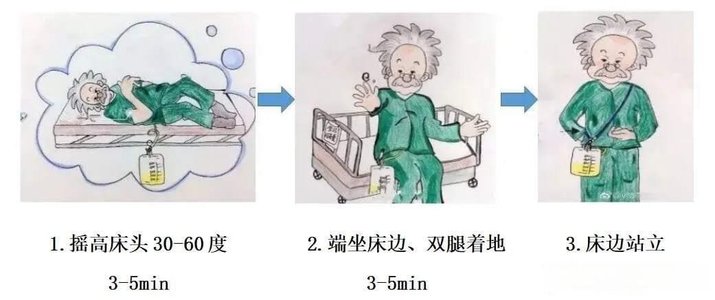 术后早期下床活动知多少