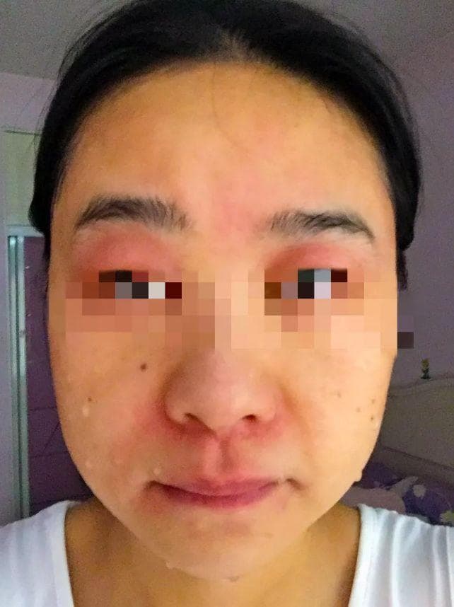5 步科学护肤， 6 位皮肤科医生帮你整理好了（短知识）