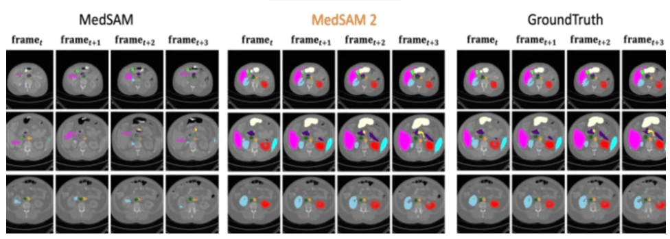 牛津大学发布Medical SAM 2，刷新医学图像分割SOTA榜