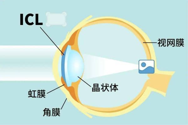 什么膜最好？全面讲解不同种类的膜及其优势