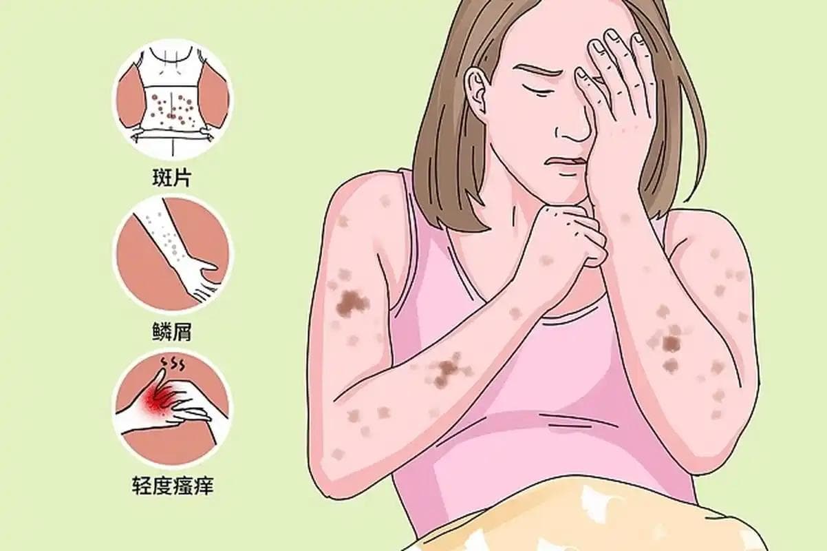 如何应对扁平疣、慢性荨麻疹和神经性皮炎：预防与治疗指南