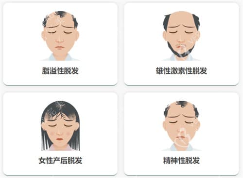 激光生发帽对脂溢性脱发/斑秃到底有用吗?激光生发帽真的能长出头发吗?