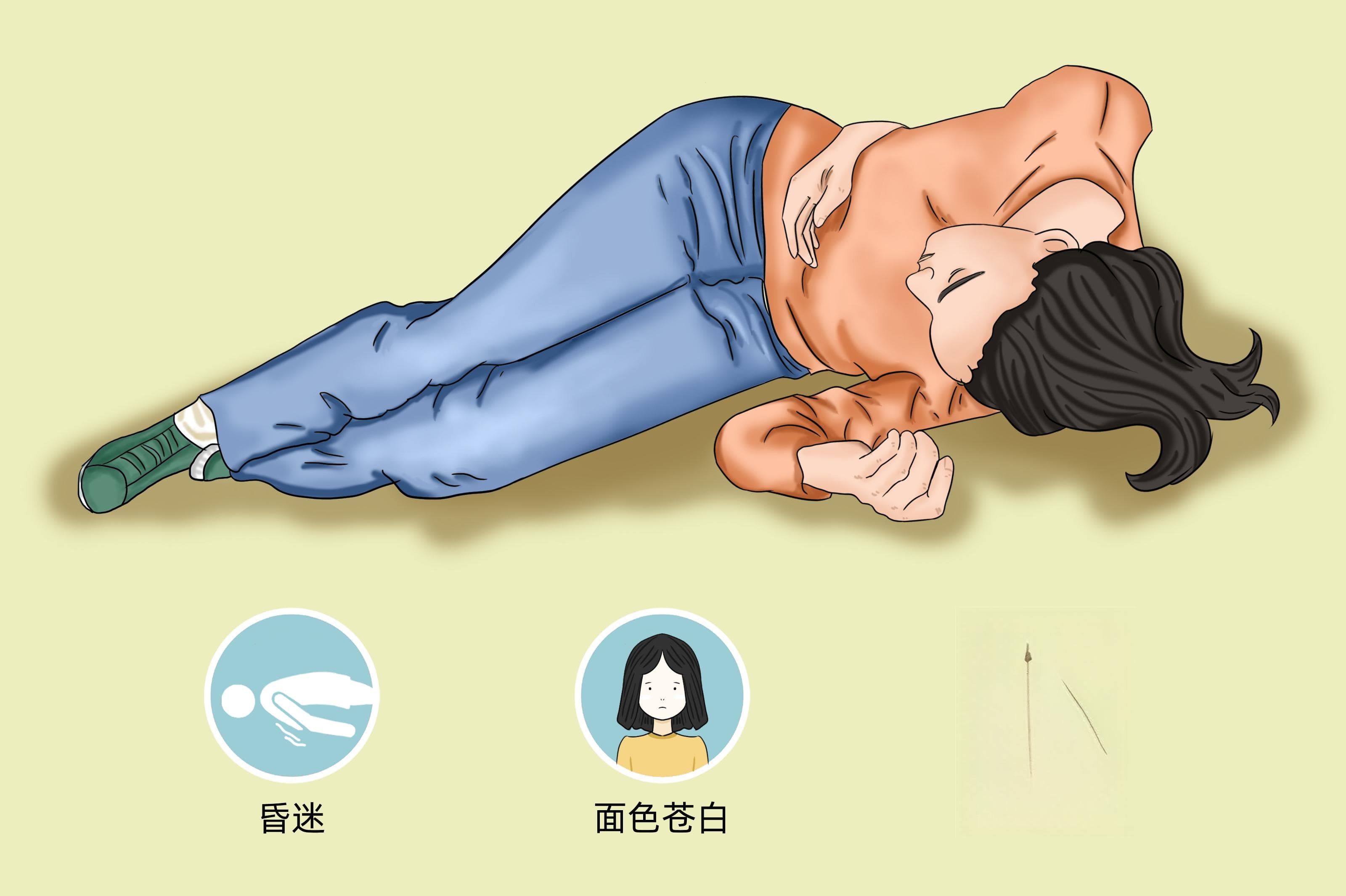 休克的诊断标准