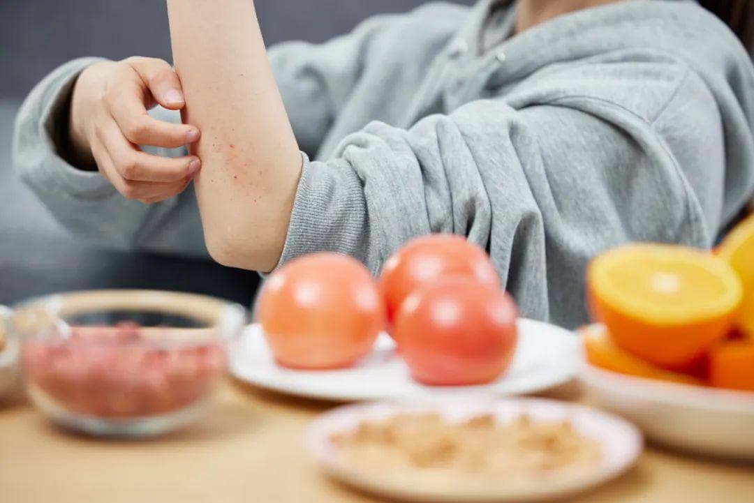 遇上奇痒无比、反复发作、难以根治的神经性皮炎，该怎么办？