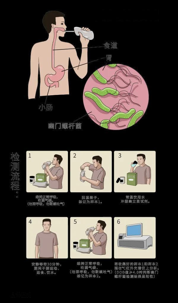 查幽门螺杆菌，碳13和碳14哪个更准？