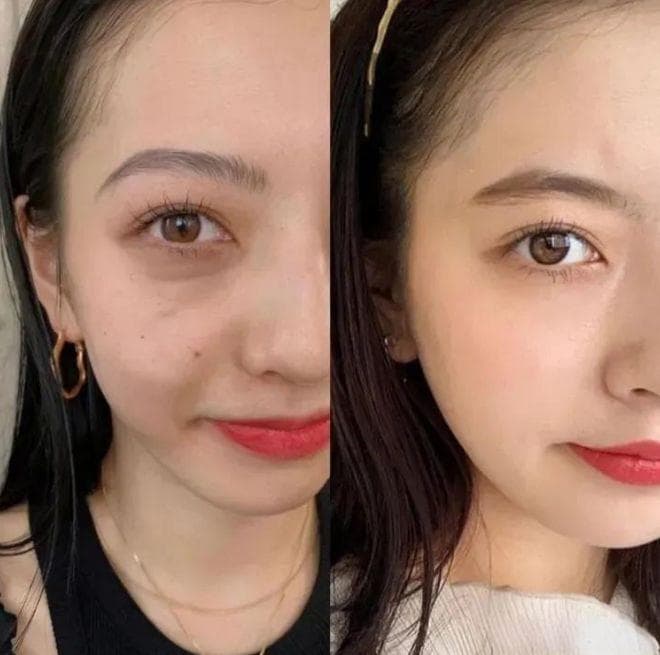 这五大神级医美抗衰老成分，你都知道吗？