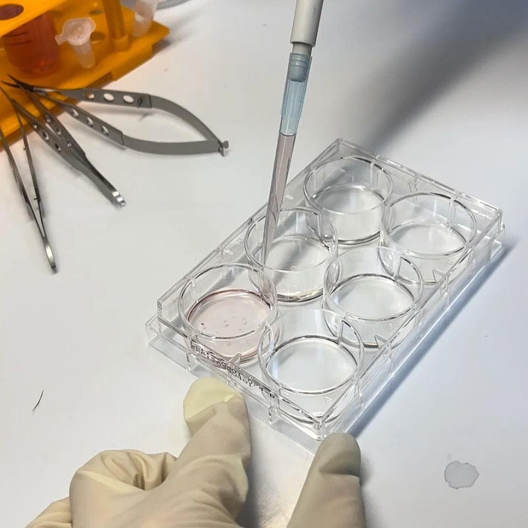 巨噬细胞原代培养中细胞贴壁的过程