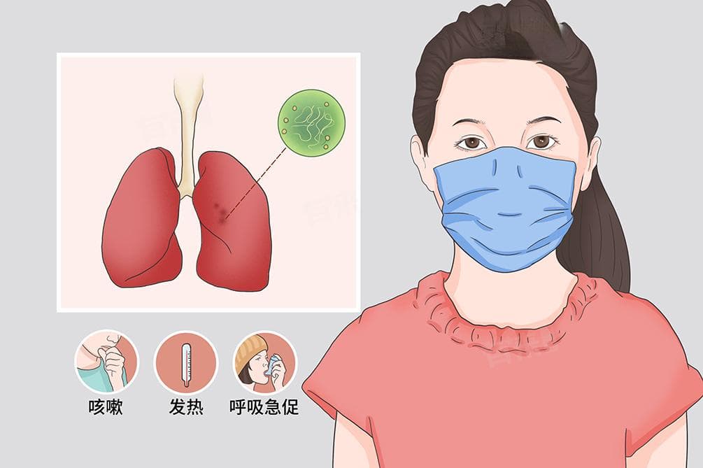 非典（SARS）：病因、传播途径、临床表现及预防措施全解析